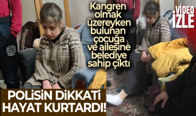 Ayakları kangren olmak üzere bulunan genç kız ölümden kurtarıldı