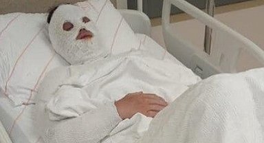 Eski nişanlısına kezzap atan şahıs "Su saatine bakacağım" bahanesiyle kapıyı açtırmış