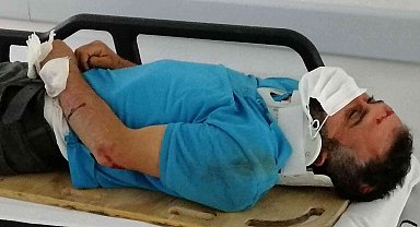 Seyir halindeki motosikletten düşen yolcu yaralandı