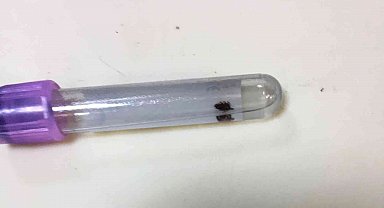 Vücuduna yapışan kene acil serviste çıkarıldı
