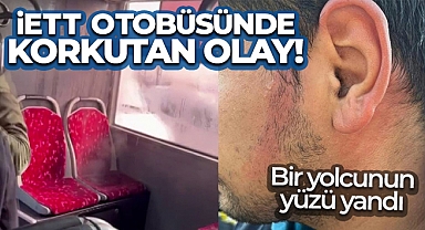 Ümraniye’de İETT otobüsünün klima borusu patladı, bir yolcunun yüzü yandı