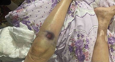 Ankara'da bakıcı dehşeti: 91 yaşındaki yaşlı kadın hastanede ölüm kalım savaşı veriyor