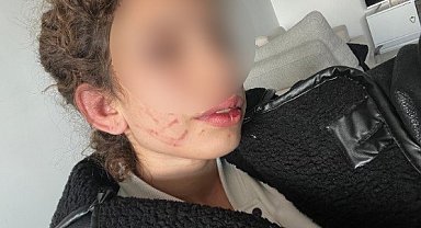 Kendisinden ayrılmak isteyen 19 yaşındaki genç kıza eski sevgiliden darp tuzağı