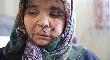 Kızlarının evine ziyarete giden anne ve baba köpeğin saldırısına uğradı