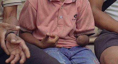 Türk belgesel ekibi komodo ejderinin saldırısında kolu ampute olan çocuğun tedavisini üstlenmek istiyor