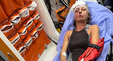 Antalya'da uzaklaştırma kararı aldıran kadın dehşeti yaşadı
