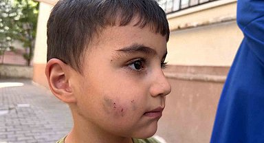 Evde uyuyan çocuğu lağım faresi ısırdı