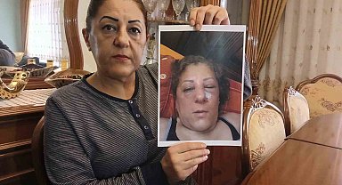 Apartman bahçesinde beslediği kediler nedeniyle komşuları tarafından darbedilen kadının burnu kırıldı